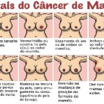 Sinais do Câncer de Mama_Faça Auto Exame